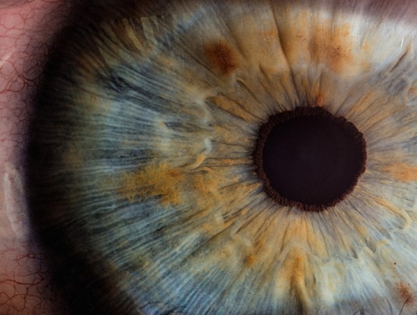 Auge Symbolbild Timolol Asthma Netzhautablösung Fluorchinolone