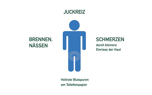 Hametum Beschwerden Hämorrhoiden