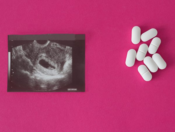 Symbolbild Ibuprofen 20 Schwangerschaftswoche