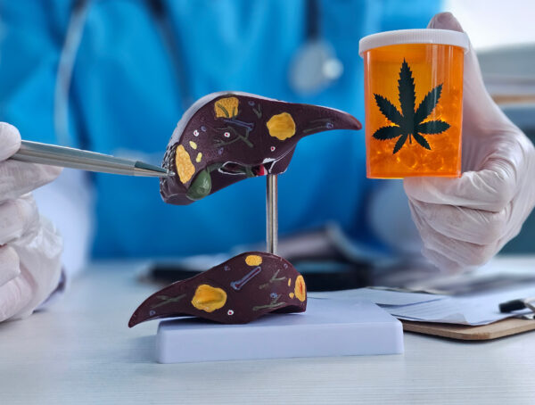 Durch das in Cannabis enthaltene CBD können die Leberwerte verdreifacht werden.