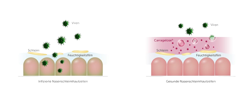 Zweiteilige Infografik vergleicht infizierte und gesunde Nasenschleimhautzellen. Links dringen Viren in die Zellen ein, rechts verhindert eine rosa Carragelose-Schutzschicht das Eindringen der Viren und schützt die Nasenschleimhaut.