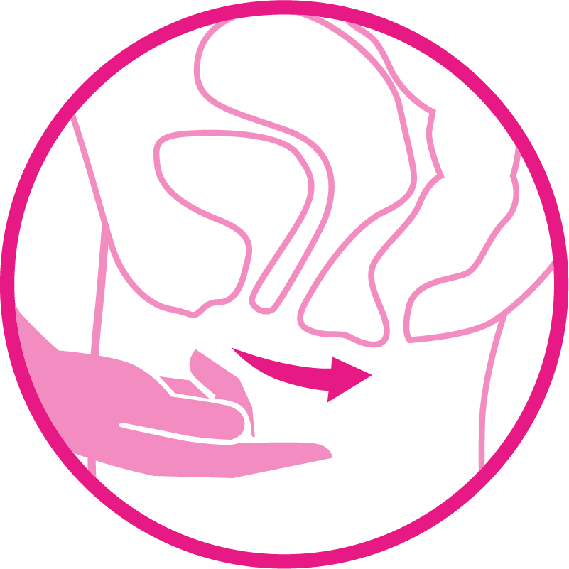 Anwendung des Gepan® Mannose-Gels