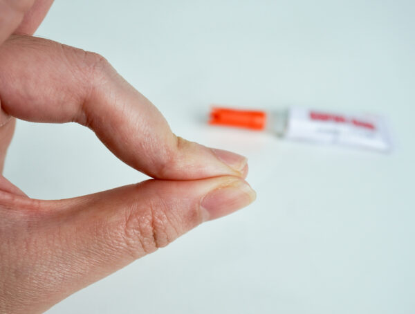 Symbolbild mit zwei zusammengedrückten Fingern und im Hintergrund einer Tube Kleber